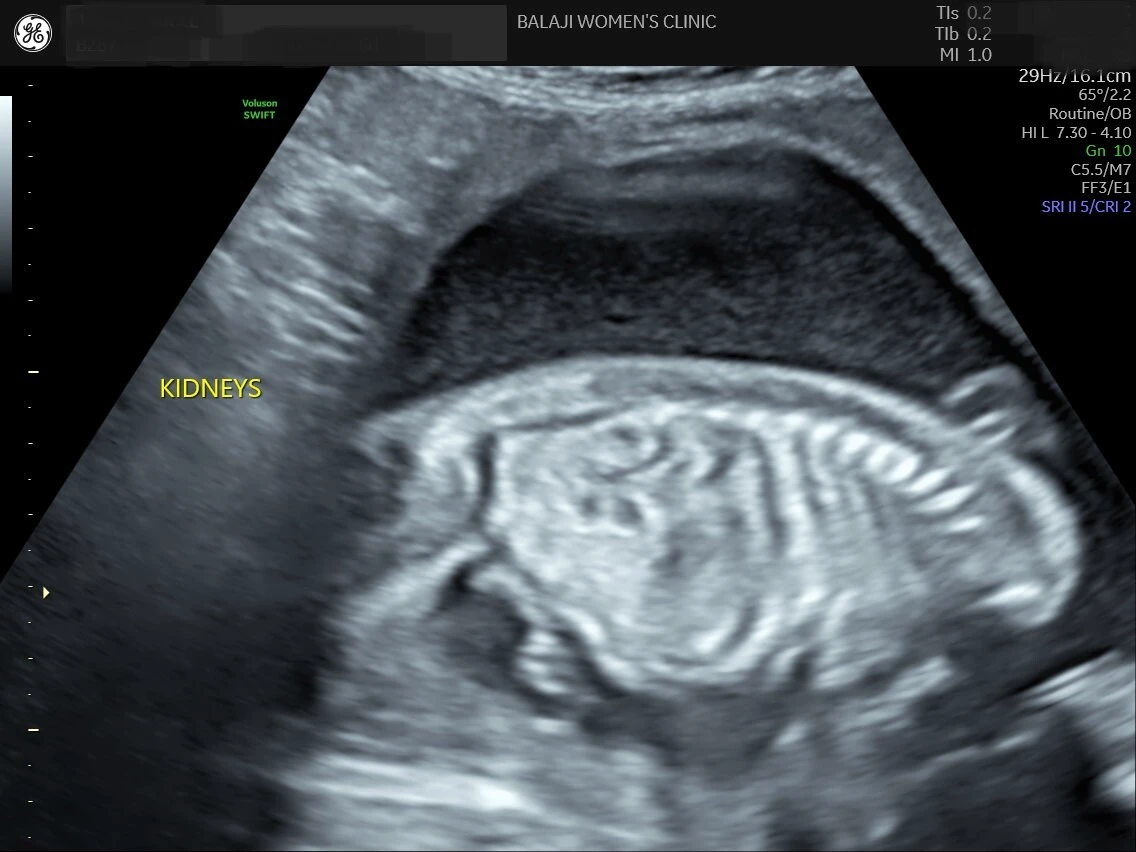 internal image 16
