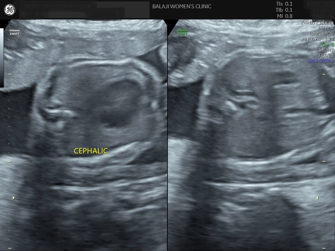 internal image 21