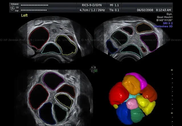 internal image 6