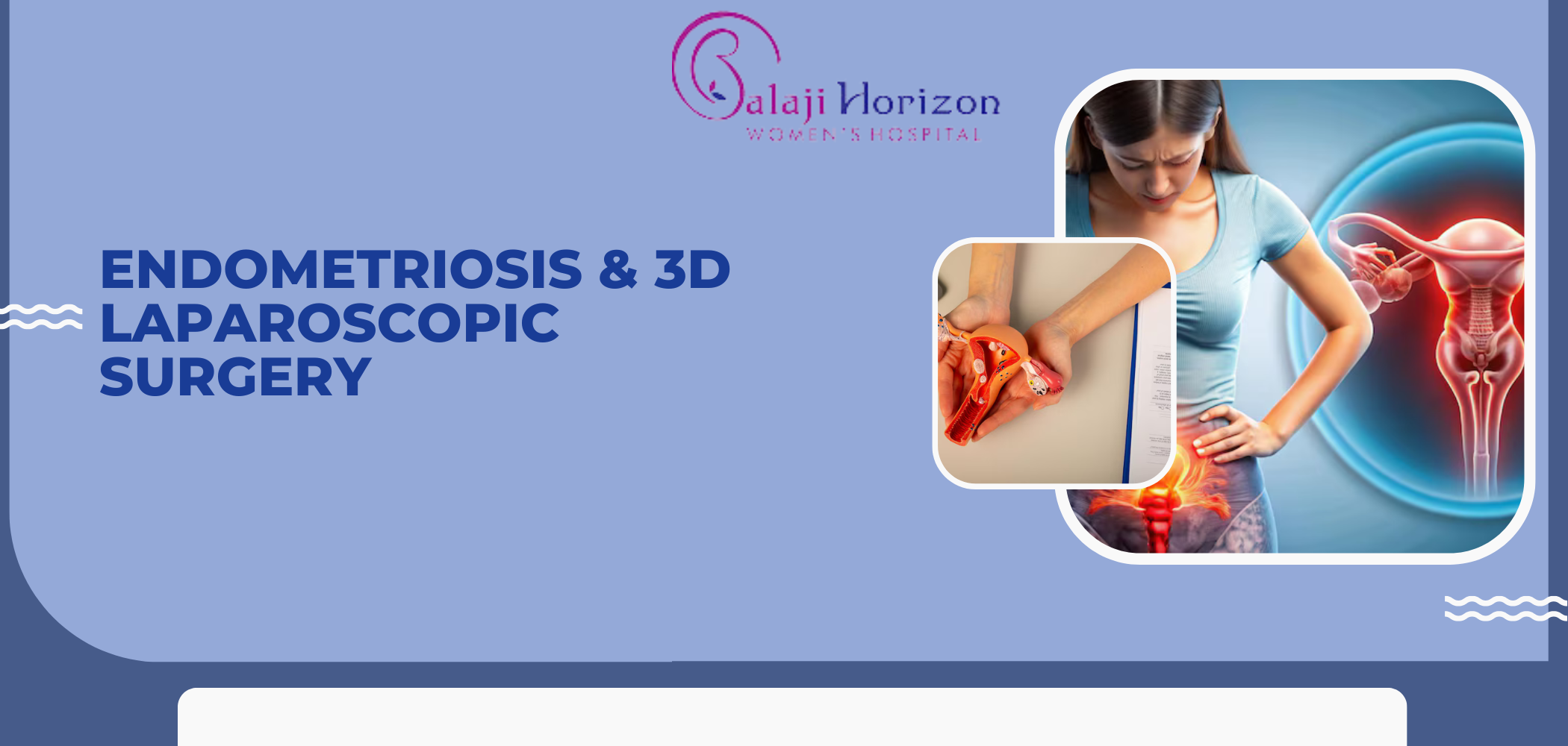 3d laparoscopic