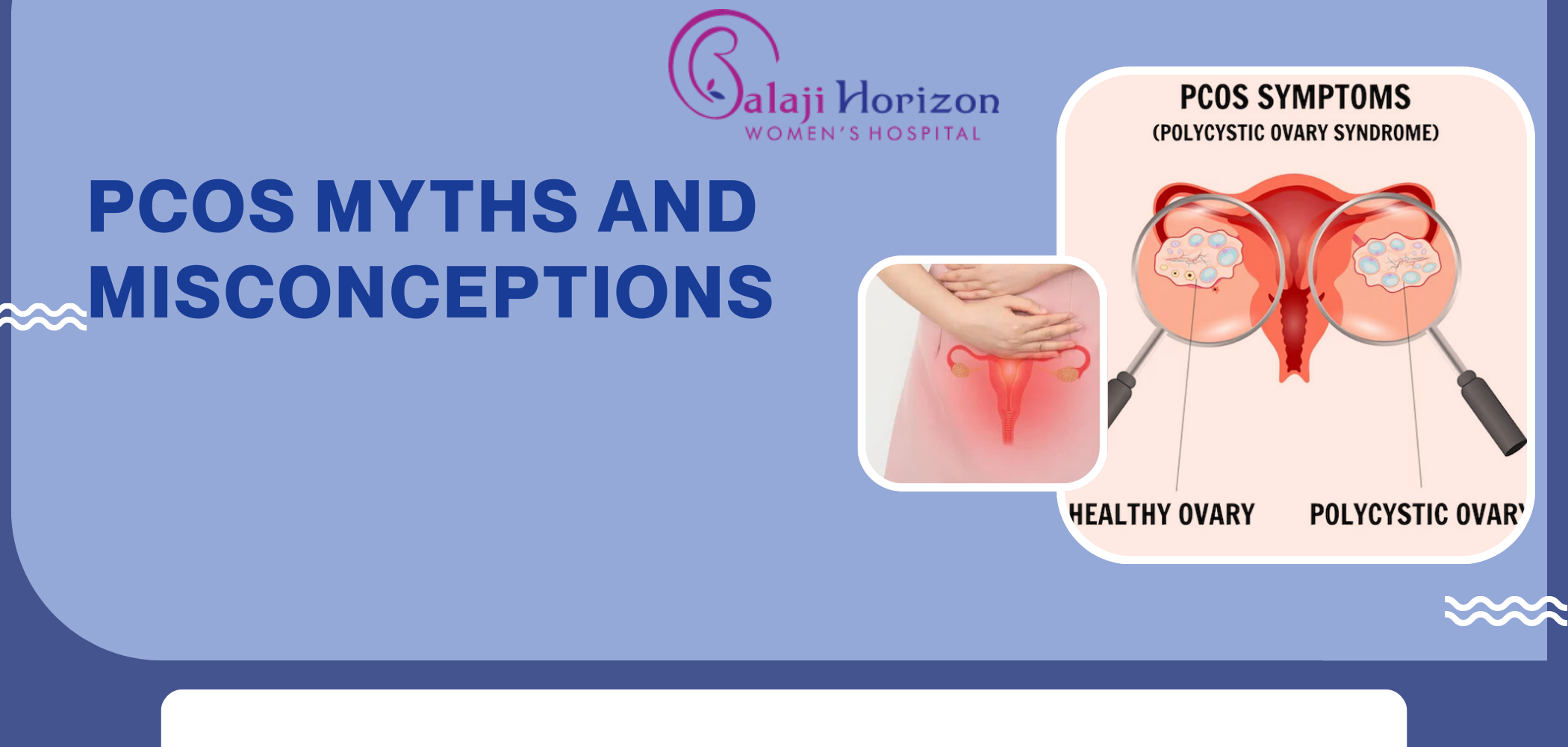 pcos misconceptions
