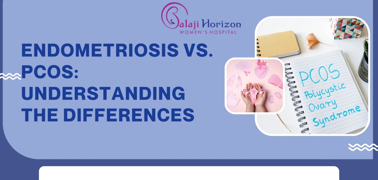 endo vs pcos