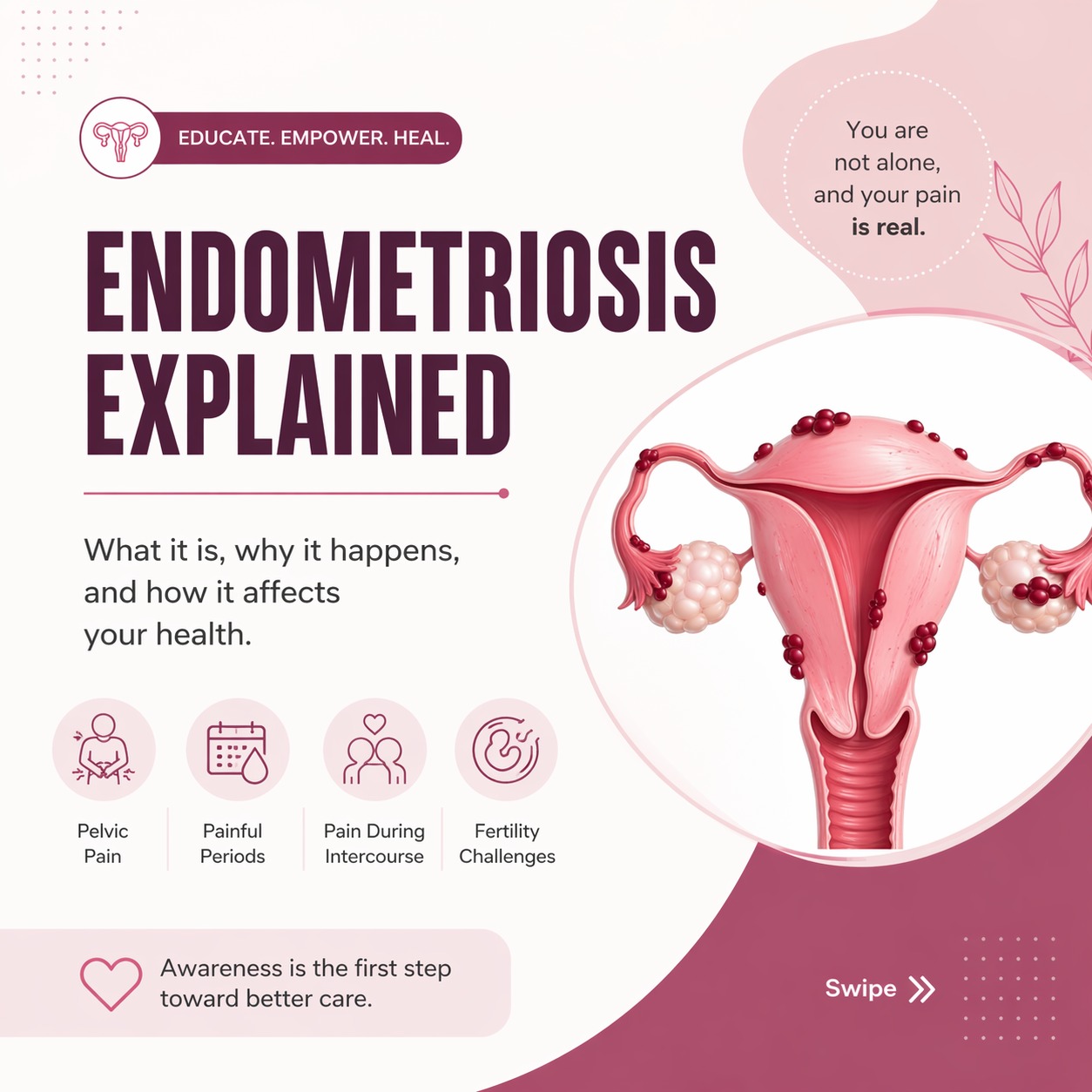 Dr. Priyadatt Patel explaining endometriosis symptoms at Balaji Horizon Women's Hospital.