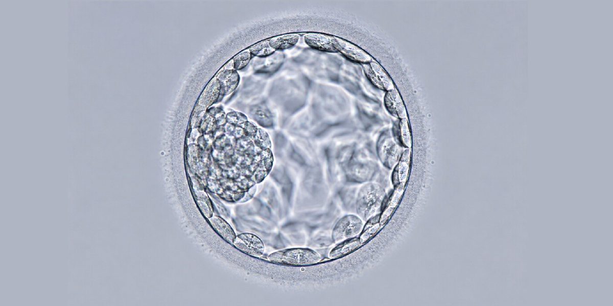 IVF Treatment Ahmedabad | Evidence-Based IVF | Balaji Horizon 2 Blastocyst-stage embryo under the microscope