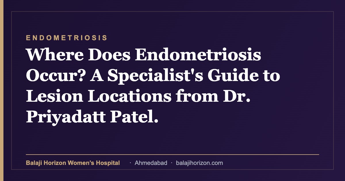 Where Does Endometriosis Occur? A Specialist’s Guide to Lesion Locations from Dr. Priyadatt Patel. — Balaji Horizon Women's Hospital, Ahmedabad