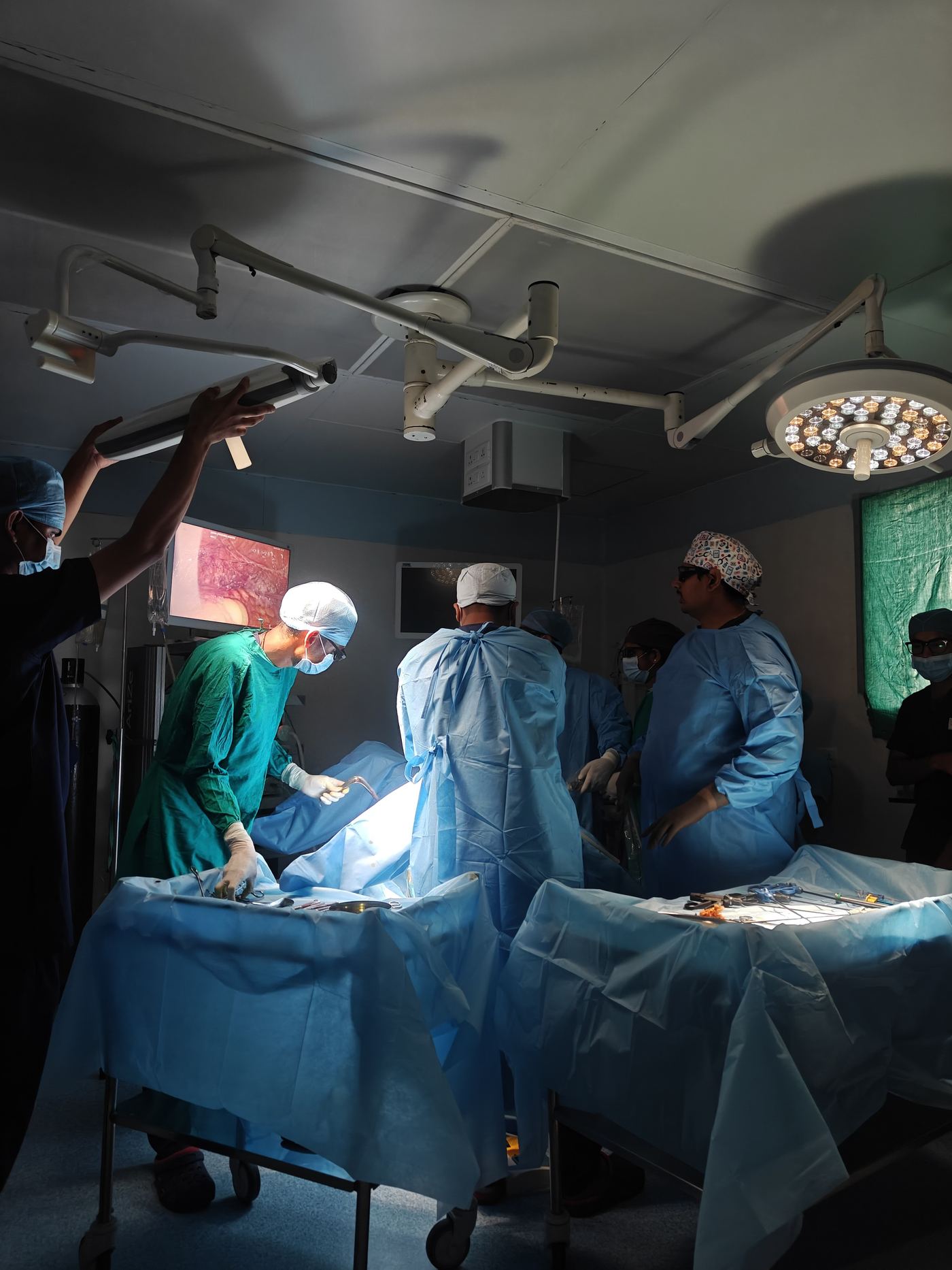 Total Laparoscopic Hysterectomy (TLH): A Complete Guide for Women Considering Surgery 2 Operating team preparing instruments for a keyhole hysterectomy