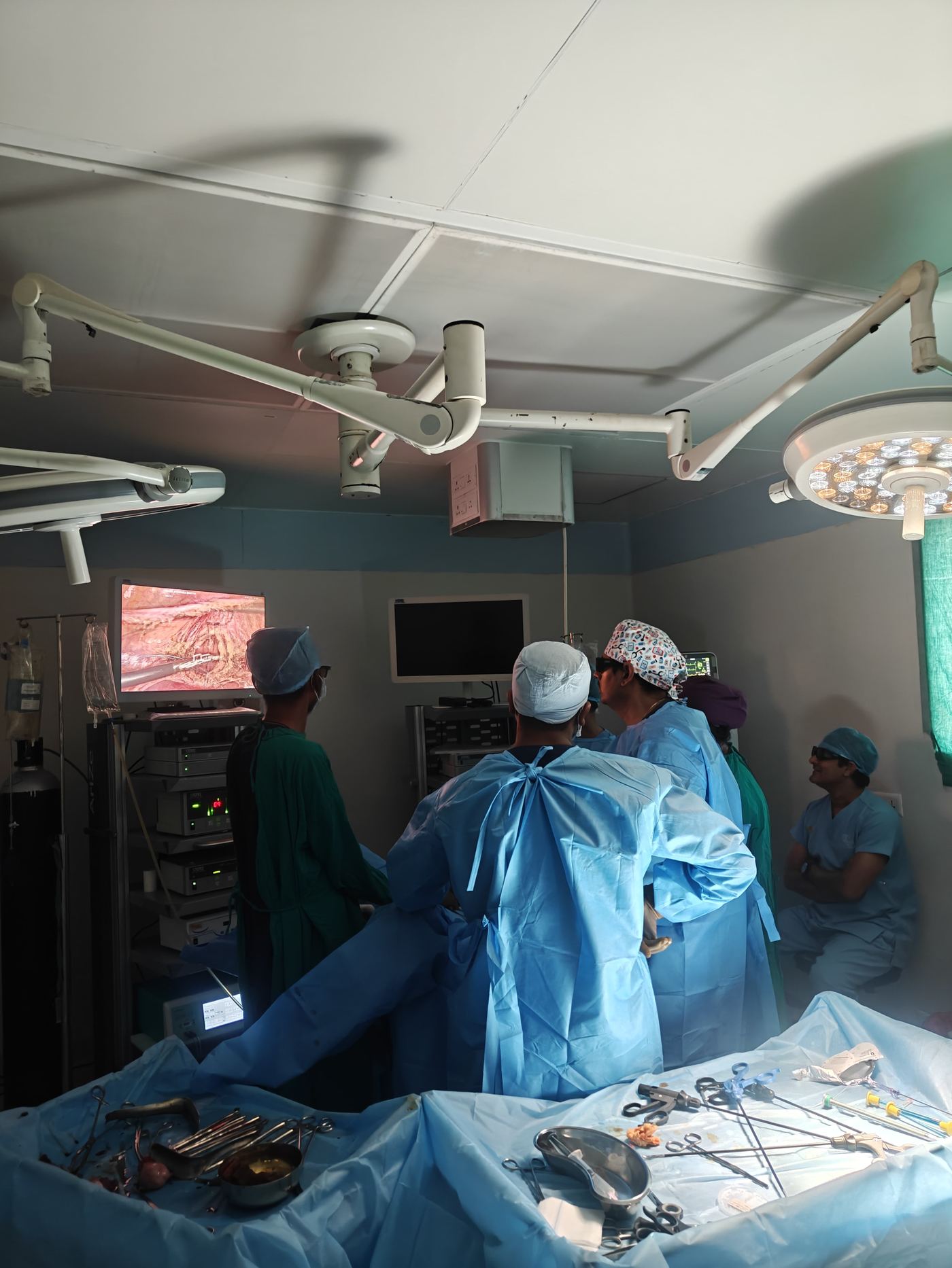 Total Laparoscopic Hysterectomy (TLH): A Complete Guide for Women Considering Surgery 3 Surgical team viewing the real-time laparoscopic monitor during hysterectomy