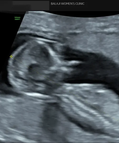 internal image 11
