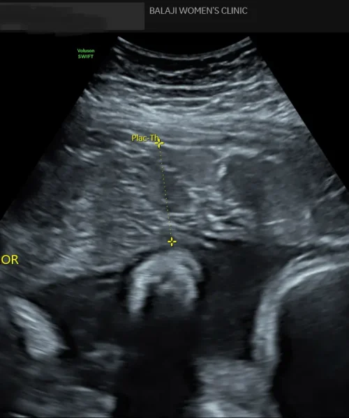 internal image 25